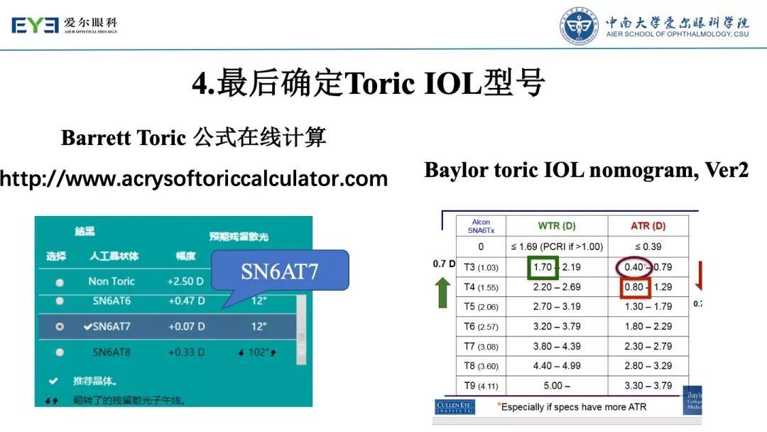 【规划未来】屈光术后散光晶体植入如何规划？