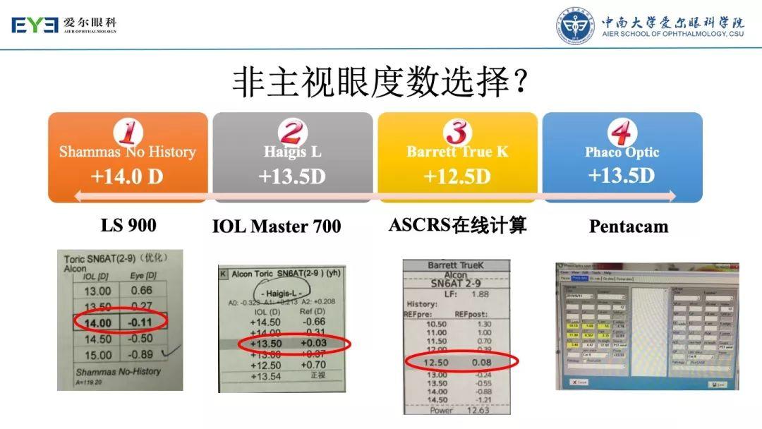 【规划未来】屈光术后散光晶体植入如何规划？