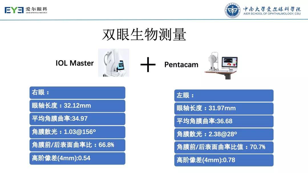 【规划未来】屈光术后散光晶体植入如何规划？