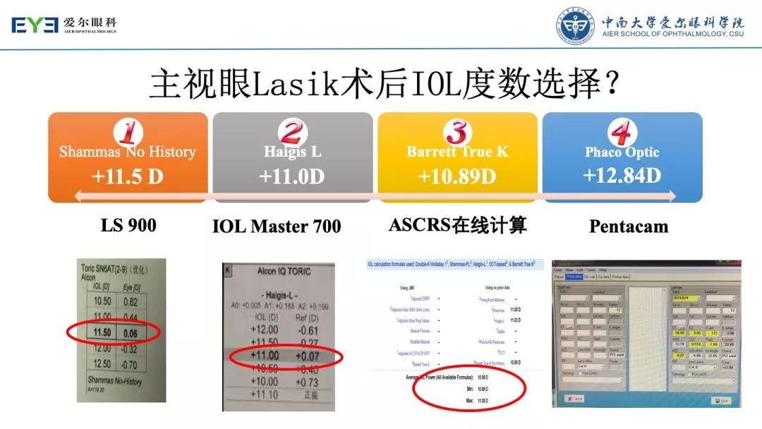 【规划未来】屈光术后散光晶体植入如何规划？