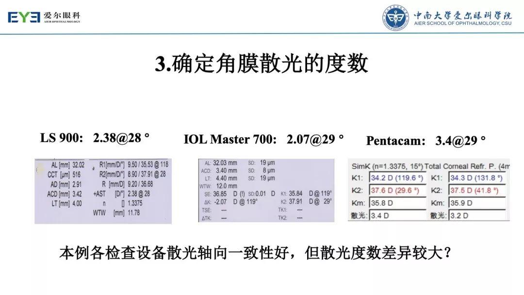 【规划未来】屈光术后散光晶体植入如何规划？