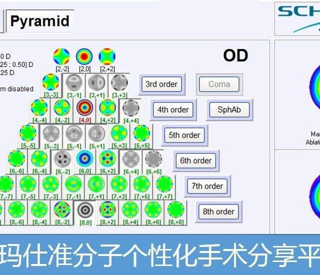 阿玛仕臻选个性化手术的标准设计流程与注意事项-屈光说