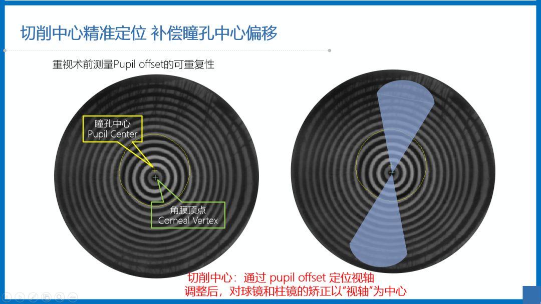 阿玛仕公开课｜张日平教授：阿玛仕准分子规范应用及常见问题揭晓