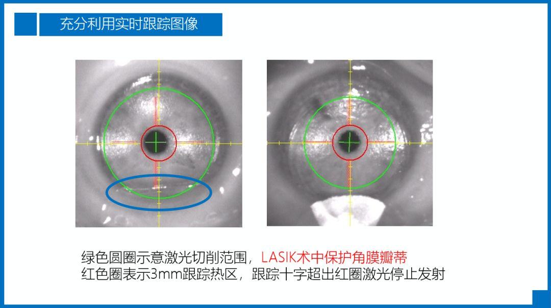 阿玛仕公开课｜张日平教授：阿玛仕准分子规范应用及常见问题揭晓