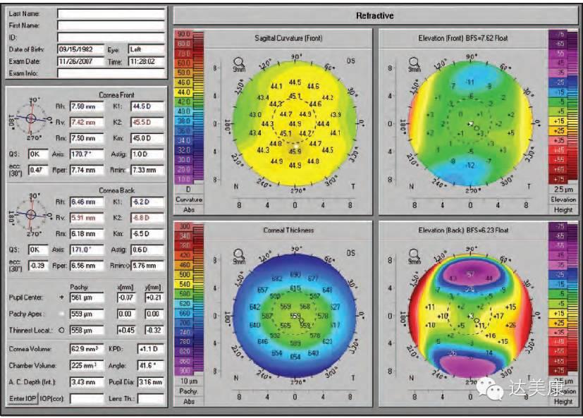 看完这10条，角膜地形图分析不再是难题！