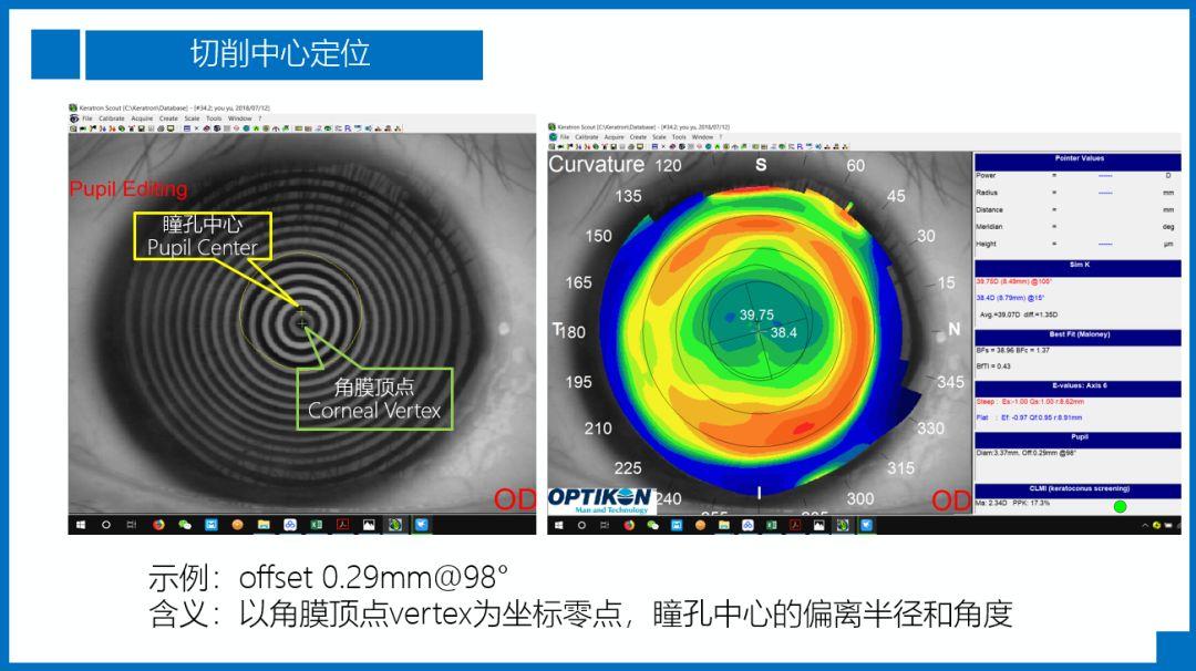 阿玛仕公开课｜张日平教授：阿玛仕准分子规范应用及常见问题揭晓