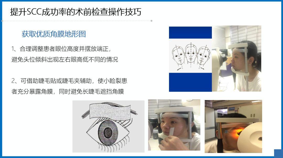 阿玛仕公开课｜张日平教授：阿玛仕准分子规范应用及常见问题揭晓