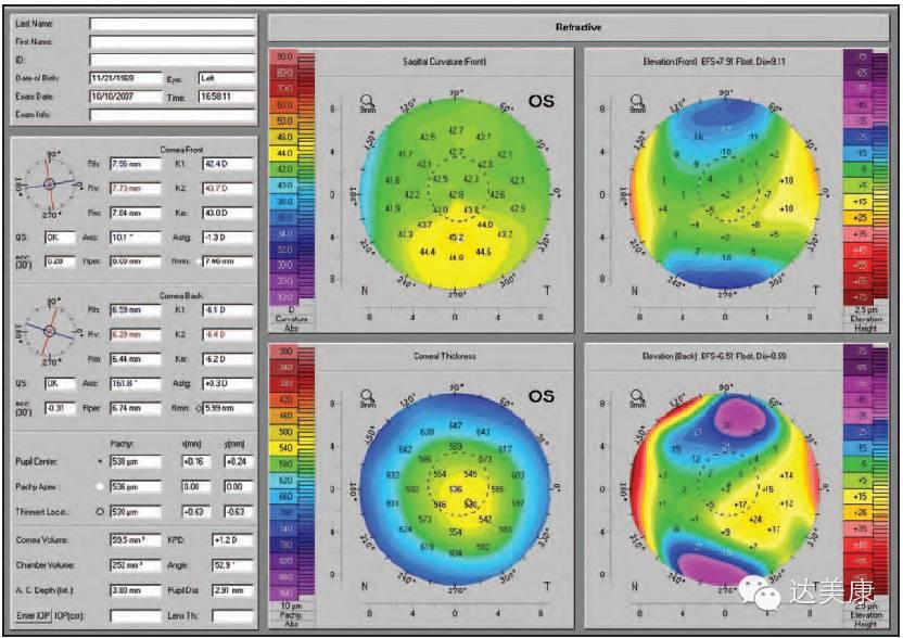 看完这10条，角膜地形图分析不再是难题！