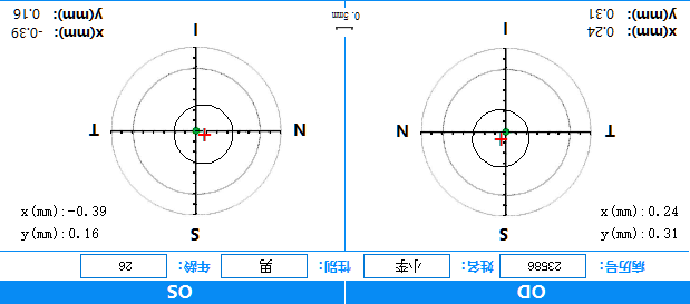 [更新2.1版]全飞秒Smile手术大Kappa角患者术中辅助应用程序