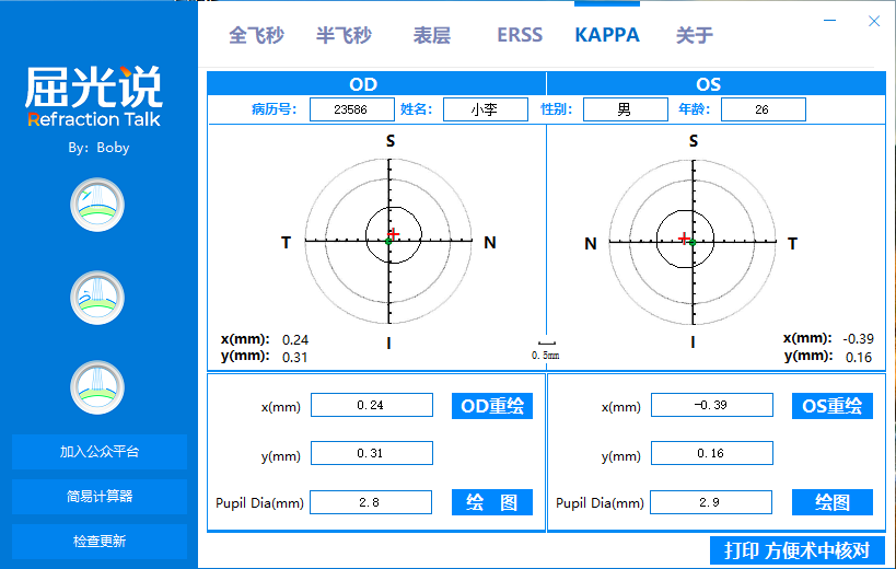 [更新2.1版]全飞秒Smile手术大Kappa角患者术中辅助应用程序