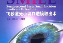 免费获取:飞秒激光小切口透镜取出术SMILE 书籍-屈光说