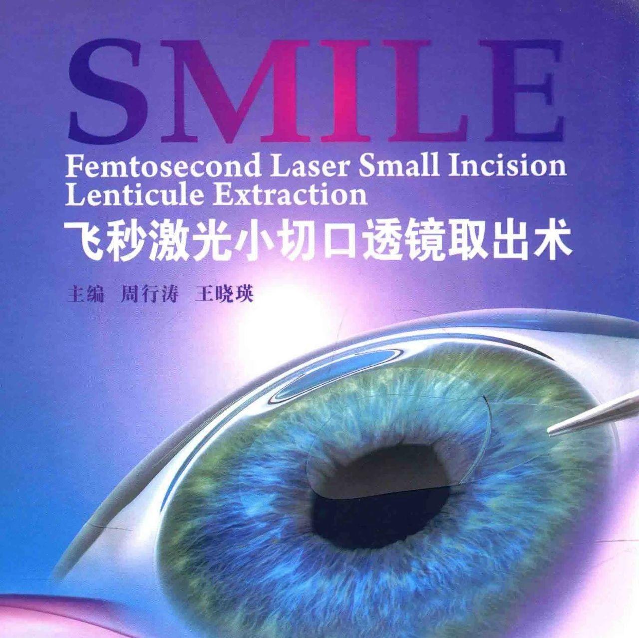 免费获取：飞秒激光小切口透镜取出术SMILE 书籍-屈光说
