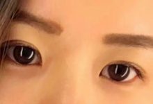 抑郁症会改变一个人的眼神（瞳孔会变大）-屈光说