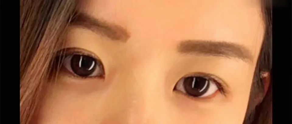 抑郁症会改变一个人的眼神（瞳孔会变大）-屈光说