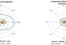 白内障术后散光分析工具-Double Angle Plot Tool-屈光说