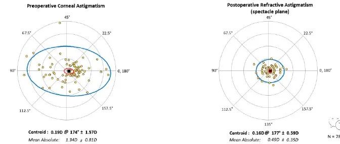 白内障术后散光分析工具-Double Angle Plot Tool-屈光说